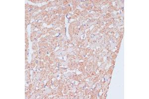 Immunohistochemistry of paraffin-embedded rat heart using MZB1 antibody (ABIN7268403) at dilution of 1:100 (40x lens). (MZB1 antibody  (AA 1-189))