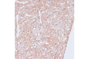 Immunohistochemistry of paraffin-embedded rat heart using MZB1 antibody (ABIN7268403) at dilution of 1:100 (40x lens). (MZB1 antibody  (AA 1-189))