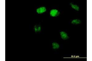 Immunofluorescence of purified MaxPab antibody to ZBTB3 on HeLa cell. (ZBTB3 antibody  (AA 1-574))