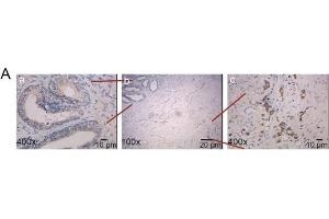 The correlation between XPNPEP2 and metastasis. (XPNPEP2 antibody  (Center))