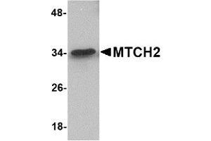 Western Blotting (WB) image for anti-Mitochondrial Carrier 2 (MTCH2) (N-Term) antibody (ABIN1031463)