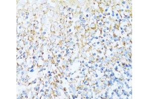 Immunohistochemistry of paraffin-embedded Human tonsil using NDUFA5 Polyclonal Antibody at dilution of 1:100 (40x lens). (NDUFA5 antibody)