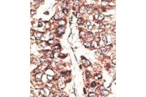 Image no. 1 for anti-Melanoma Antigen Family A, 11 (MAGEA11) (N-Term) antibody (ABIN358642) (MAGEA11 antibody  (N-Term))