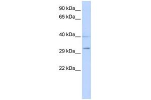 WB Suggested Anti-SIRT5 Antibody Titration:  0. (SIRT5 antibody  (Middle Region))