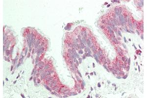 Rabbit Anti-KIAA0317 antibody  Formalin Fixed Paraffin Embedded Tissue: Human Lung, Respiratory Epithelium Primary antibody Concentration: 1:100 Secondary Antibody: Donkey anti-Rabbit-Cy3 Secondary Antibody Concentration: 1:200 Magnification: 20x Exposure Time: 0. (AREL1 antibody  (N-Term))