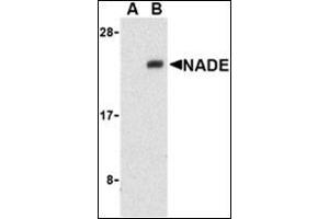 Western blot analysis of NADE in Human brain cell lysates with this product at 1 μg/ml in the presence (A) or absence (B) of blocking peptide. (Nerve Growth Factor Receptor (TNFRSF16) Associated Protein 1 (NGFRAP1) (Middle Region) antibody)