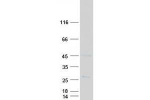 Validation with Western Blot