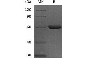 Western Blotting (WB) image for Fibrinogen-Like 1 (FGL1) (Active) protein (Fc Tag) (ABIN7319769) (FGL1 Protein (Fc Tag))