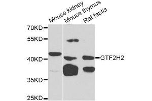 Western blot analysis of extracts of various cell lines, using GTF2H2 Antibody (ABIN5975366) at 1/1000 dilution. (GTF2H2 antibody)