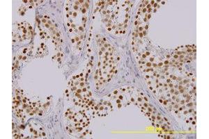 Image no. 1 for anti-TAO Kinase 1 (TAOK1) (AA 892-1002) antibody (ABIN599290) (TAO Kinase 1 (TAOK1) (AA 892-1002) antibody)