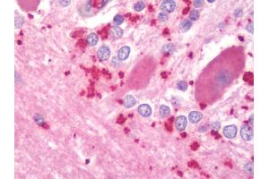Anti-PPP3CA / CCN1 / Calcineurin A antibody IHC staining of human brain, cerebellum. (PPP3CA antibody  (AA 364-283))