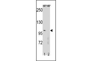Western blot analysis of CTNNB1 Antibody (N-term) Pab (ABIN1881235 and ABIN2843231) pre-incubated without(lane 1) and with(lane 2) blocking peptide in human placenta tissue lysate. (CTNNB1 antibody  (N-Term))