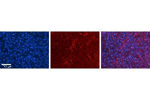Rabbit Anti-MLX Antibody   Formalin Fixed Paraffin Embedded Tissue: Human Liver Tissue Observed Staining: Cytoplasm in endothelial cells in sinusoids Primary Antibody Concentration: N/A Other Working Concentrations: 1:600 Secondary Antibody: Donkey anti-Rabbit-Cy3 Secondary Antibody Concentration: 1:200 Magnification: 20X Exposure Time: 0. (MLX antibody  (N-Term))