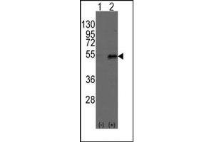 Image no. 1 for anti-Dystrobrevin Binding Protein 1 (DTNBP1) (C-Term) antibody (ABIN357846) (DTNBP1 antibody  (C-Term))
