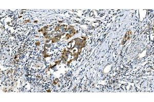 IHC analysis of DRP1/DNM1L using anti-DRP1/DNM1L antibody (ABIN7602180).