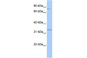 WB Suggested Anti-RFPL4B Antibody Titration:  0. (RFPL4B antibody  (Middle Region))