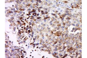 MAGEB3 antibody  (AA 201-300)