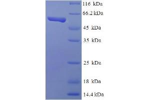 SDS-PAGE (SDS) image for TEA Domain Family Member 4 (TEAD4) (AA 74-434), (partial) protein (His-SUMO Tag) (ABIN4976628)