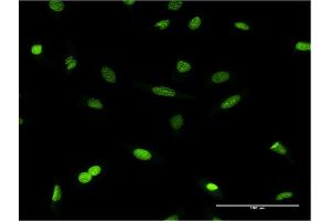 Immunofluorescence of monoclonal antibody to CBX1 on HeLa cell. (CBX1 antibody  (AA 2-99))