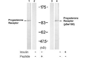 Image no. 2 for anti-Progesterone Receptor (PGR) (Ser190) antibody (ABIN319298) (Progesterone Receptor antibody  (Ser190))