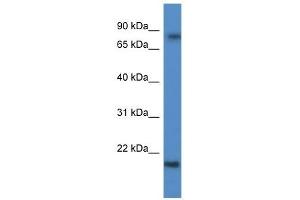 Western Blot showing KRTAP1-5 antibody used at a concentration of 1 ug/ml against Fetal Brain Lysate (KRTAP1-5 antibody  (C-Term))