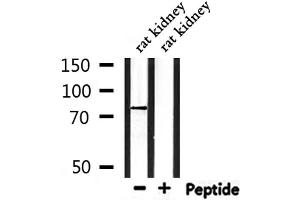 Western Blotting (WB) image for anti-Carnitine Palmitoyltransferase 2 (CPT2) (Internal Region) antibody (ABIN6266193)