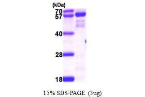 SDS-PAGE (SDS) image for N-Myristoyltransferase 2 (NMT2) (AA 1-498) protein (His tag) (ABIN667348)