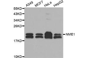 Western blot analysis of extracts of various cell lines, using NME1 antibody (ABIN5970089) at 1/1000 dilution.