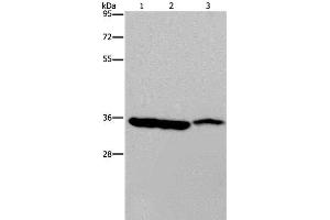 Western Blot analysis of Mouse heart, liver and stomach tissue using MDH1 Polyclonal Antibody at dilution of 1:500 (MDH1 antibody)