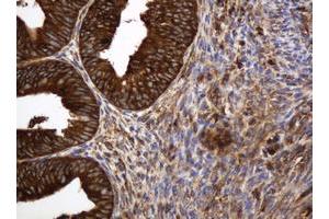 Image no. 2 for anti-TAP Binding Protein-Like (TAPBPL) antibody (ABIN1501302) (TAPBPL antibody)