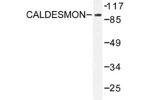 Image no. 1 for anti-Caldesmon 1 (CALD1) antibody (ABIN271923) (Caldesmon antibody)