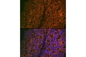 Immunofluorescence analysis of mouse large intestine cells using CE Rabbit mAb (ABIN7266085) at dilution of 1:100 (40x lens). (CEACAM6 antibody)