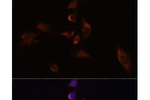 Immunofluorescence analysis of C6 cells using ELAVL3 Polyclonal Antibody at dilution of 1:100 (40x lens). (HuC/ELAVL3 antibody)