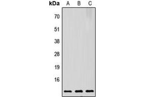 Western blot analysis of Prothymosin alpha expression in HeLa (A), Raw264. (PTMA antibody  (C-Term))