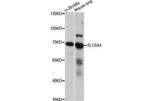 Western blot analysis of extracts of various cell lines, using SLC6A4 antibody. (SLC6A4 antibody)