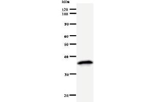 Western Blotting (WB) image for anti-Mediator Complex Subunit 26 (MED26) antibody (ABIN931047) (MED26 antibody)