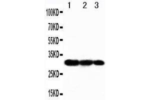 Western Blotting (WB) image for anti-TNF Receptor-Associated Factor 3 (TRAF3) (AA 387-403), (Middle Region) antibody (ABIN3042952) (TRAF3 antibody  (Middle Region))