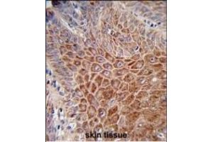 Formalin-fixed and paraffin-embedded human skin reacted with IGH Antibody (C-Term), which was peroxidase-conjugated to the secondary antibody, followed by DAB staining. (IgH antibody  (C-Term))