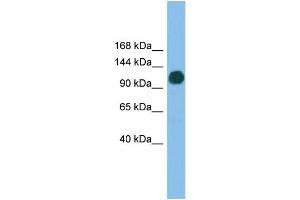 WB Suggested Anti-USP36 Antibody Titration: 0. (USP36 antibody  (N-Term))