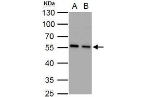 WB Image SQSTM1 antibody [N3C1], Internal detects SQSTM1 protein by western blot analysis.