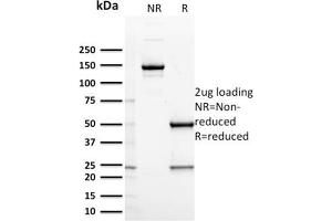 SDS-PAGE Analysis Purified CD127 Mouse Monoclonal Antibody (IL7R/2751). (IL7R antibody  (AA 21-236))