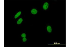 Immunofluorescence of purified MaxPab antibody to ZNF435 on HeLa cell. (ZSCAN16 antibody  (AA 1-348))
