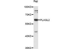 Western blot analysis of extracts of Raji cells, using PLAGL2 antibody (ABIN6292250) at 1:3000 dilution. (PLAGL2 antibody)