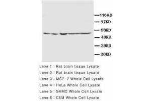 Image no. 2 for anti-Presenilin 2 (Alzheimer Disease 4) (PSEN2) (AA 319-334) antibody (ABIN1493957) (Presenilin 2 antibody  (AA 319-334))