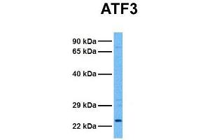 Host:  Rabbit  Target Name:  ATF3  Sample Tissue:  Human 293T  Antibody Dilution:  1. (ATF3 antibody  (Middle Region))