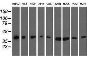 Western blot analysis of extracts (35 µg) from 9 different cell lines by using anti-HIBCH monoclonal antibody. (HIBCH antibody)