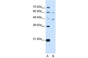 CRELD1 antibody used at 5 ug/ml to detect target protein. (CRELD1 antibody  (C-Term))