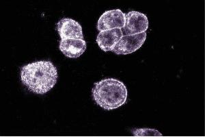 Pax-5 staining on paraformaldehyde-fixed SW-13 cells.