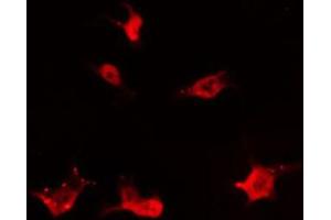ABIN6266733 staining 293 by IF/ICC. (MOS antibody)