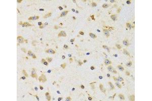 Immunohistochemistry of paraffin-embedded Rat brain using RPS12 Polyclonal Antibody at dilution of 1:100 (40x lens). (RPS12 antibody)